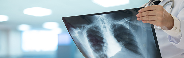 <h1 class='entry-title h2-style'>La importancia de la radiología</h1><div id='b' style='margin-bottom: 10px;'> <span class='sb'><br><strong>Alba Gomollón Garzón, Patricia Ochoa Pérez, Yamila Evelina Quintana Di Blasi,  Marina Extramiana Esquisabel y Yaiza Loreto Aranguren Herrero</strong></span></b>