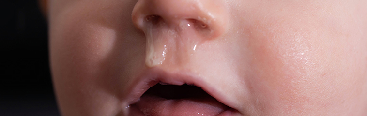 <h1 class='entry-title h2-style'>Se acerca la época de la bronquiolitis</h1><div id='b' style='margin-bottom: 10px;'> <span class='sb'><br><strong>María Erroz Ferrer, Isabel Gordo Baztán, Andrea Alonso Marín y Jorge Álvarez García</strong></span></b>