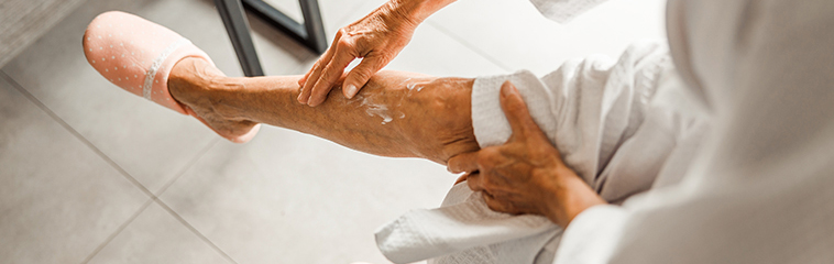 <h1 class='entry-title h2-style'>Dermatosis y úlceras de miembros inferiores en primavera: cuidados y prevención</h1><div id='b' style='margin-bottom: 10px;'> <span class='sb'><br><strong>Ana Lydia Sánchez Aso.</strong> FEA Geriatria. Hospital General de la Defensa, Zaragoza</span></b>