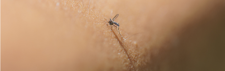 <h1 class='entry-title h2-style'>Problemas en la piel en verano</h1><div id='b' style='margin-bottom: 10px;'> <span class='sb'><br><strong>Ana Isabel Sesma García, María Elena Carasusán Vela, Jil Joselito Calderón Paredes, Karina Lissette Calderón Paredes, Ricardo Castellano Sánchez,Mercedes Alonso Bueno, Diego Calvo Tesan y Raquel Arilla Gil</strong></span></b>